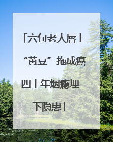 六旬老人唇上“黄豆”拖成癌 四十年烟瘾埋下隐患